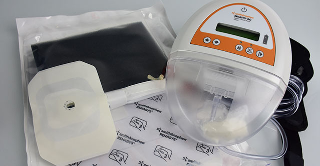 Fasciotomy and negative pressure wound therapy - eazygugl